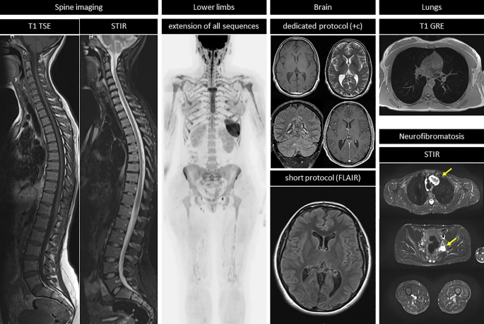 Specialized MRI screenings showing brain spine lungs and body imaging for targeted medical diagnosis